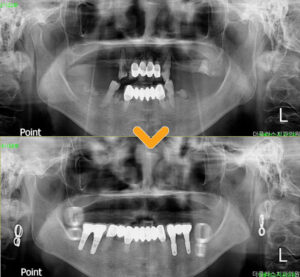 수암동치과 치료 이미지