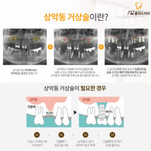 대현동치과 치료 설명 이미지